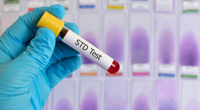 How STD Test Dubai Can Help You Stay Safe and Healthy in the UAE